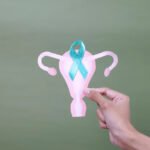 Todo lo que debes saber para detectar y tratar el cáncer de cuello uterino a tiempo