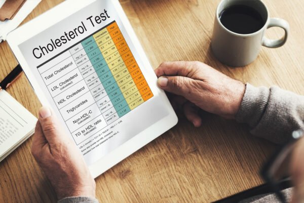 Controlar el colesterol LDL en Colombia: la clave para salvar miles de vidas y optimizar el gasto en salud