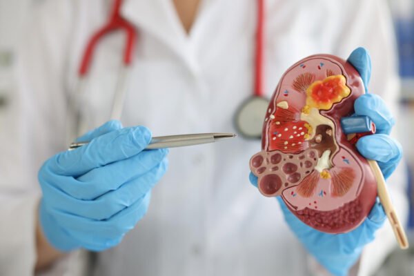 Enfermedad Renal Crónica: un riesgo invisible