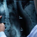 ¿Recibes más radiación en un avión o en una radiografía? 