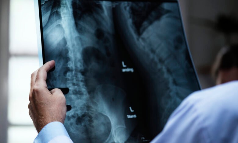 ¿Recibes más radiación en un avión o en una radiografía? 