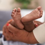 Menos nacimientos, nuevos desafíos para los pacientes quemados: el futuro de la membrana amniótica en Colombia